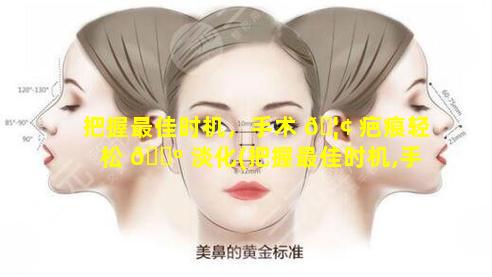 把握最佳时机，手术 🦢 疤痕轻松 🐺 淡化(把握最佳时机,手术疤痕轻松淡化的方法)